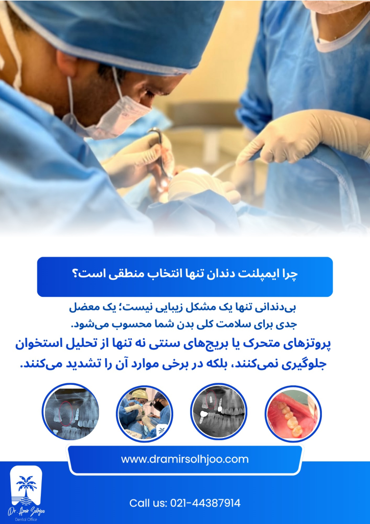 ایمپلنت دندان