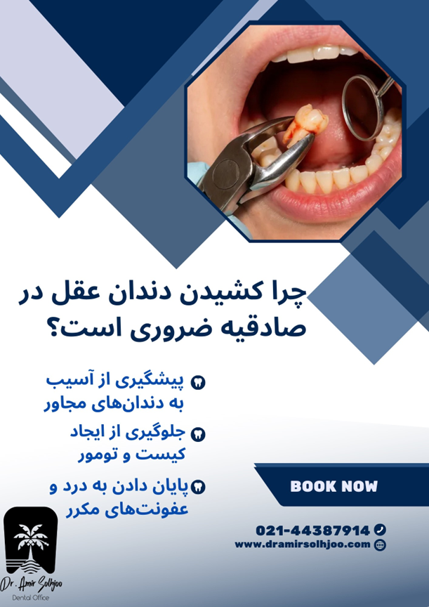بهترین کلینیک کشیدن دندان عقل در صادقیه