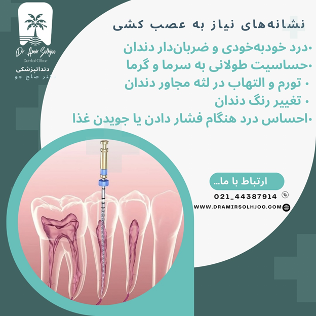 عصبکشی در سعادت آباد