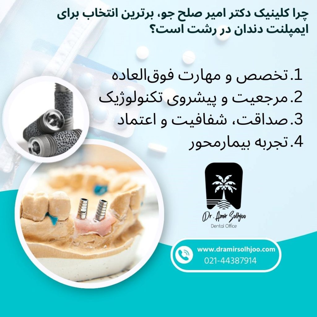 ایمپلنت دندان در رشت
