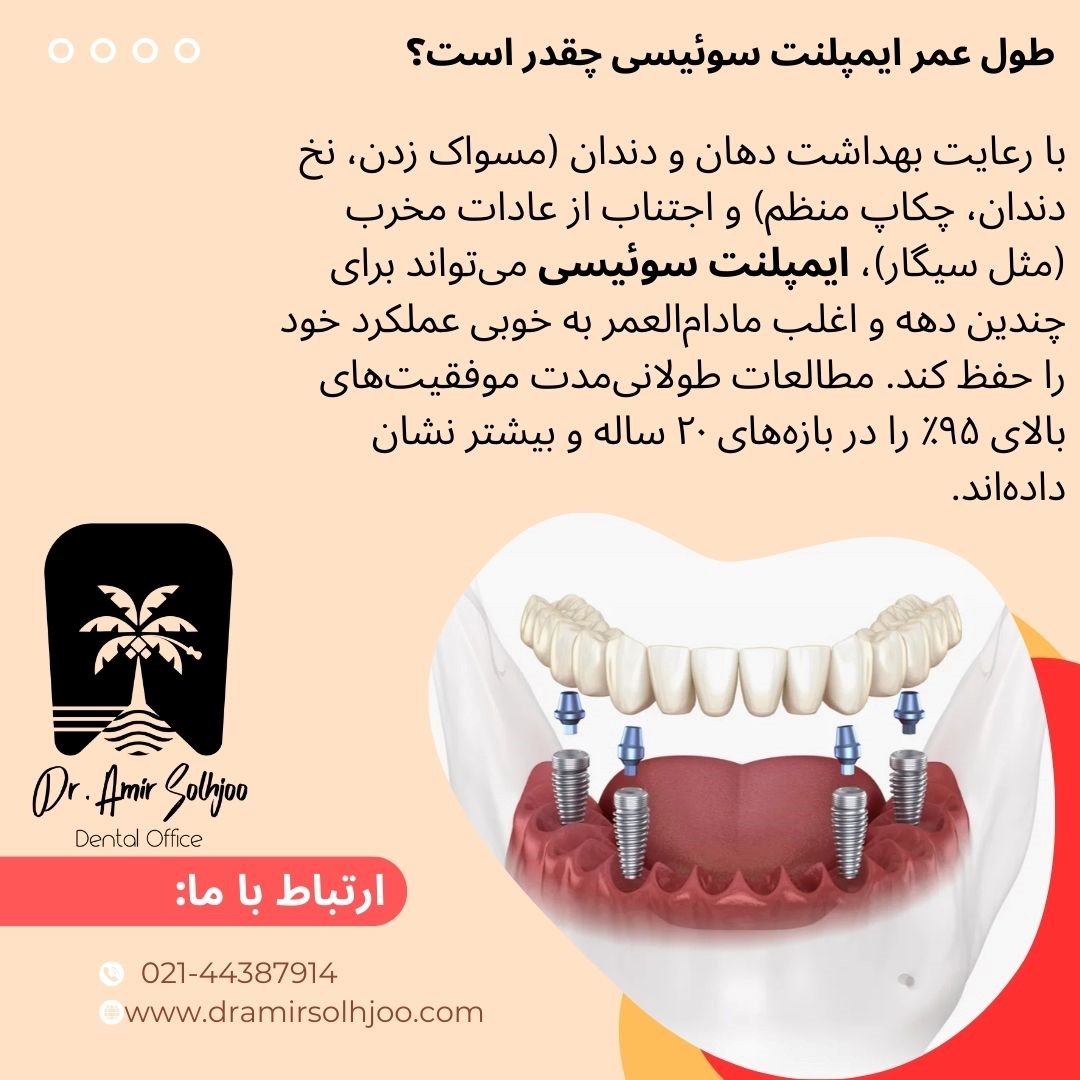 ایمپلنت سوِیسی