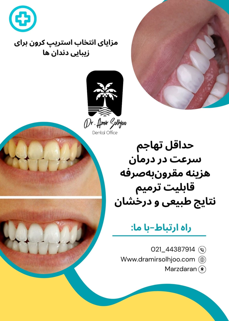 مزایای استریپ کرون