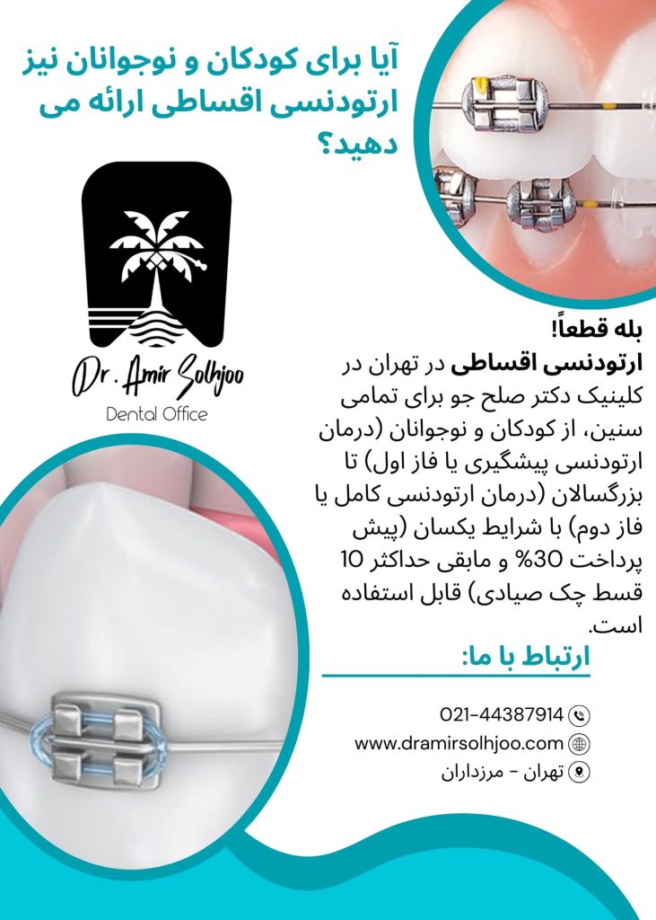 ارتودنسی اقساطی در تهران