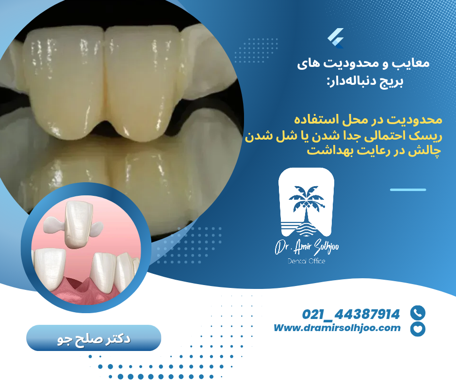 بریج دنباله دار