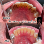 جرمگیری تضمینی در سعادت آباد