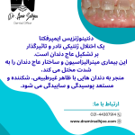 دنتینوژنزیس ایمپرفکتا
