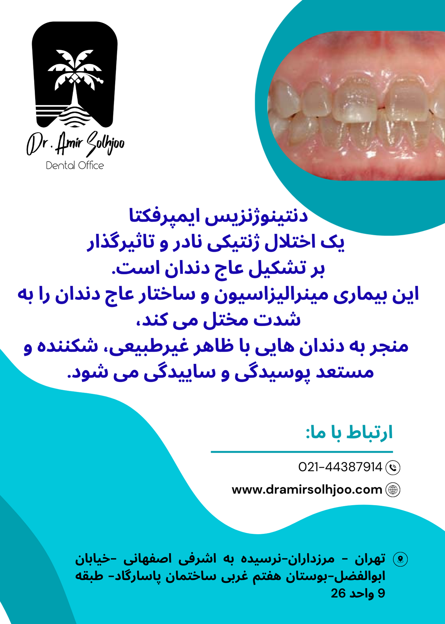 دنتینوژنزیس ایمپرفکتا