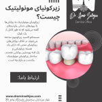 زیرکونیای مونولیتیک