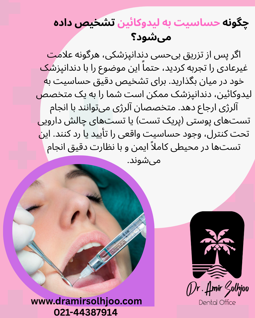 حساسیت به لیدوکائین