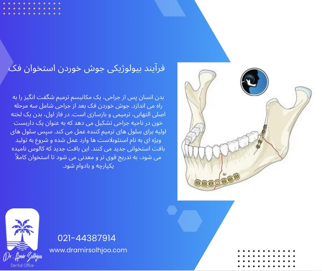 جوش خوردن فک بعد از جراحی