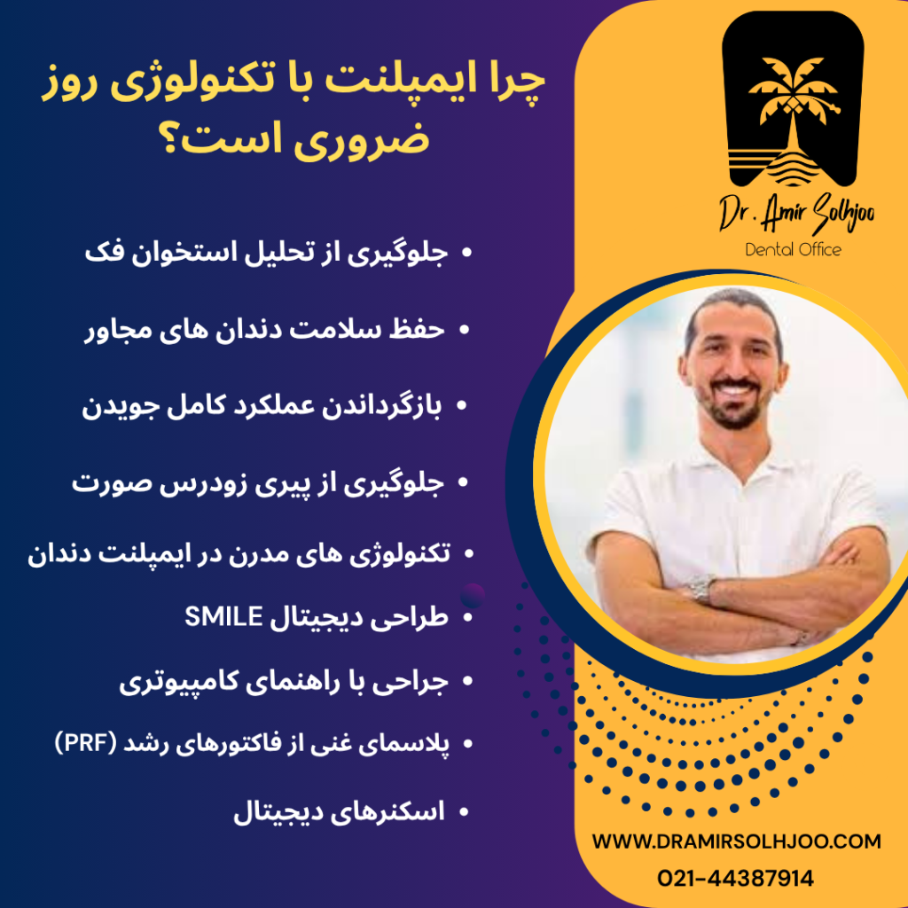 ایمپلنت با تکنولوژی روز