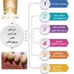 جراحی فلپ پریودنتال