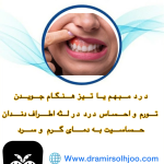 شکستگی ریشه دندان