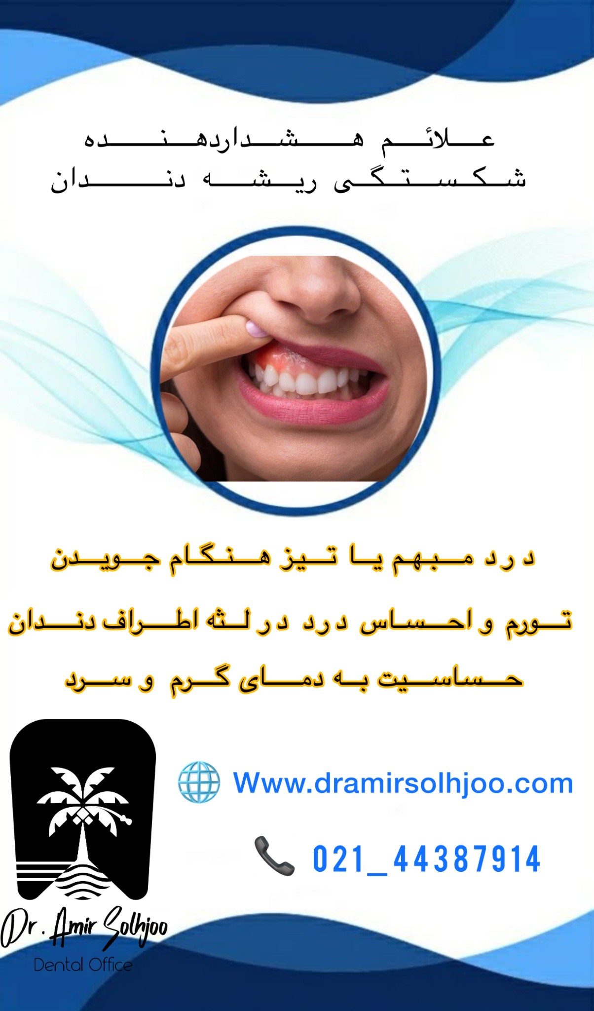 شکستگی ریشه دندان