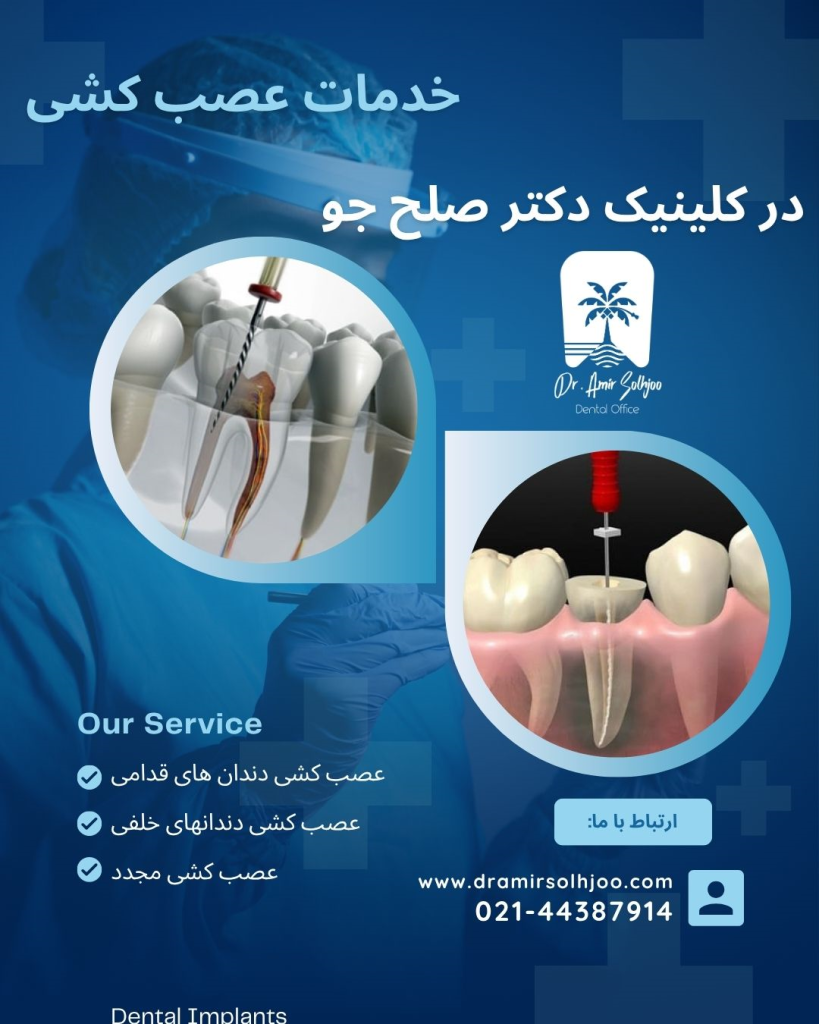 دکتر خوب برای عصب کشی در مرزداران