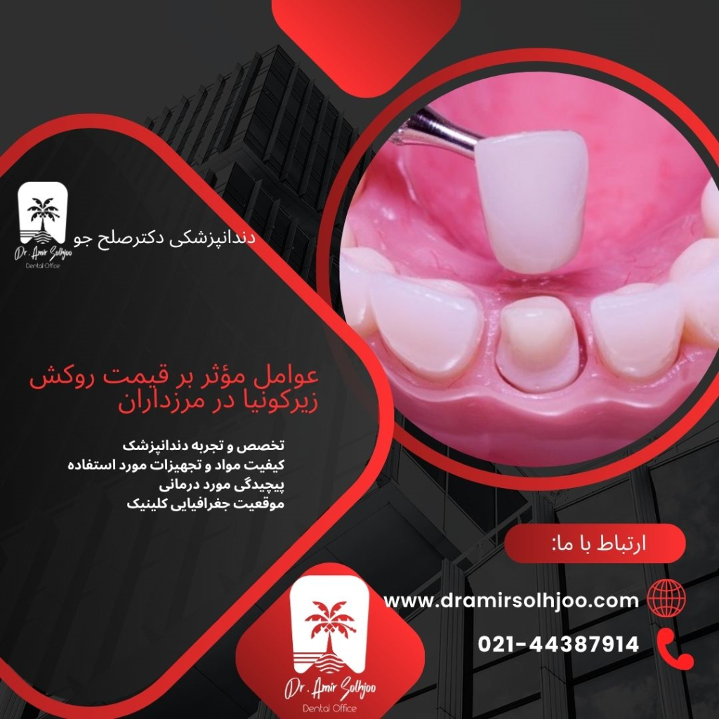 قیمت روکش زیرکونیا در مرزداران