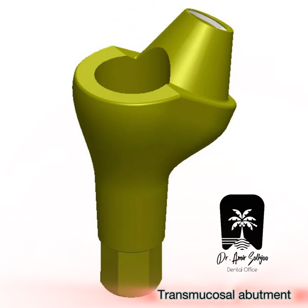 اباتمنت transmucosal