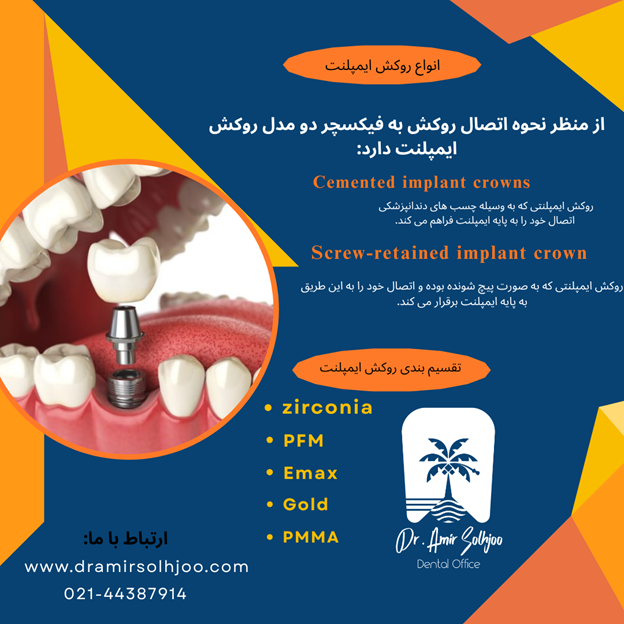 روکش PMMA