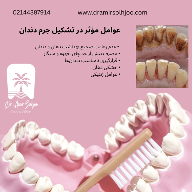 جرم گیری دندان در گیشا