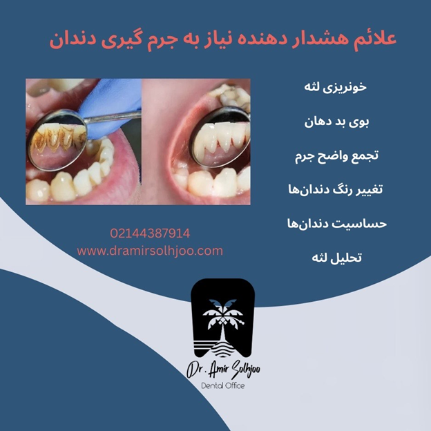 جرمگیری دندان در صادقیه