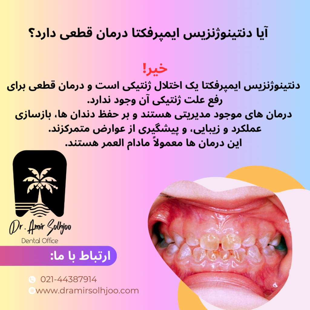 دنتینوژنزیس ایمپرفکتا
