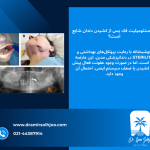 عفونت استخوان استئومیلیت