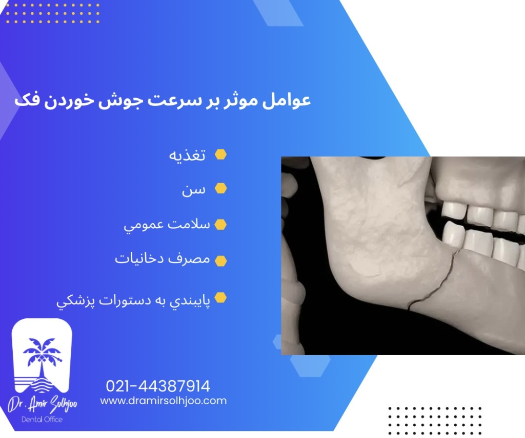 جوش خوردن فک بعد از جراحی