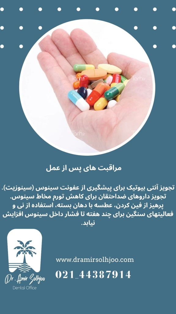 پرفوراسیون سینوس در جراحی فک