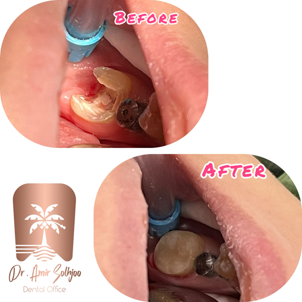 مطب دندانپزشکی لاکچری در شیخ بهایی تهران