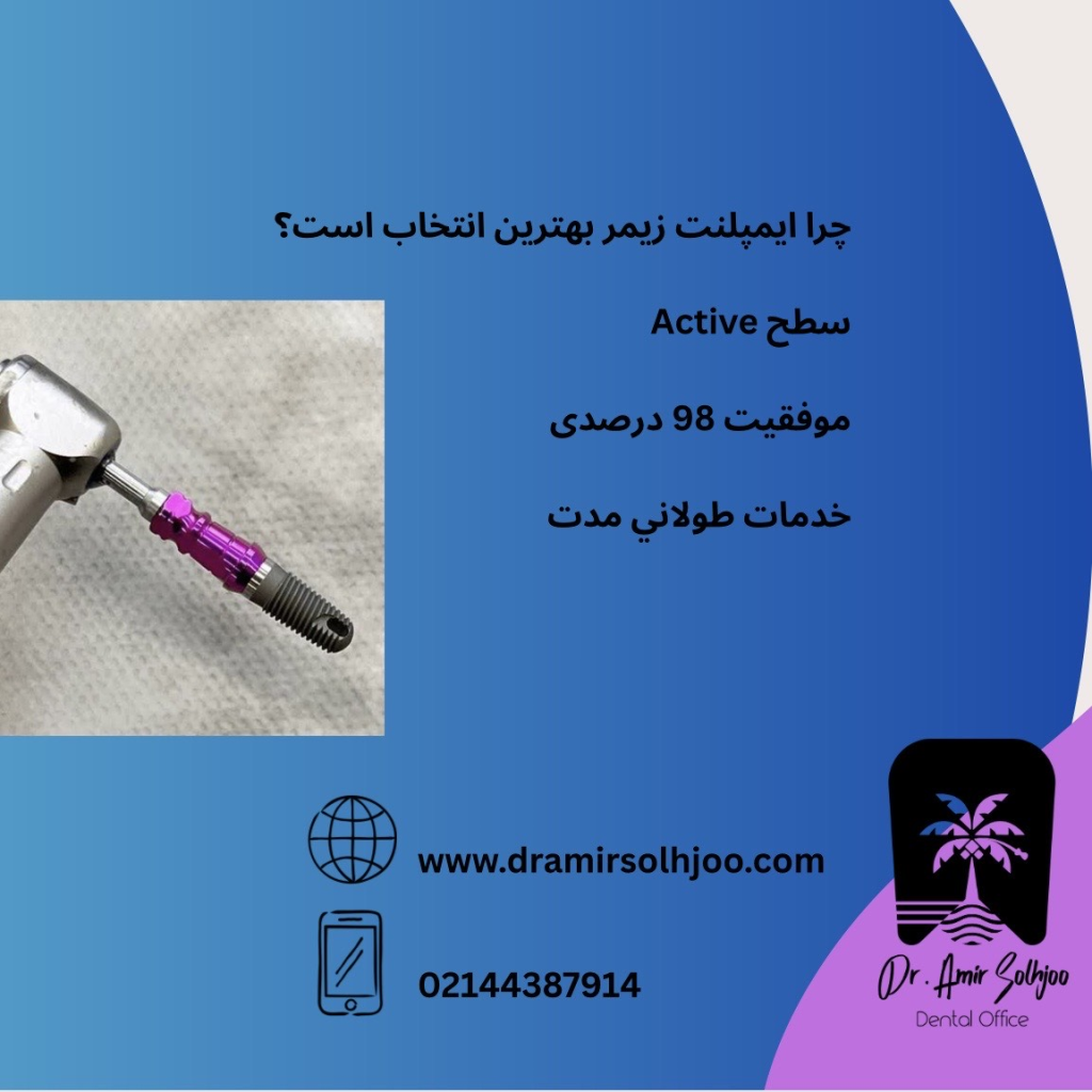 هزینه ایمپلنت دندان در ایران