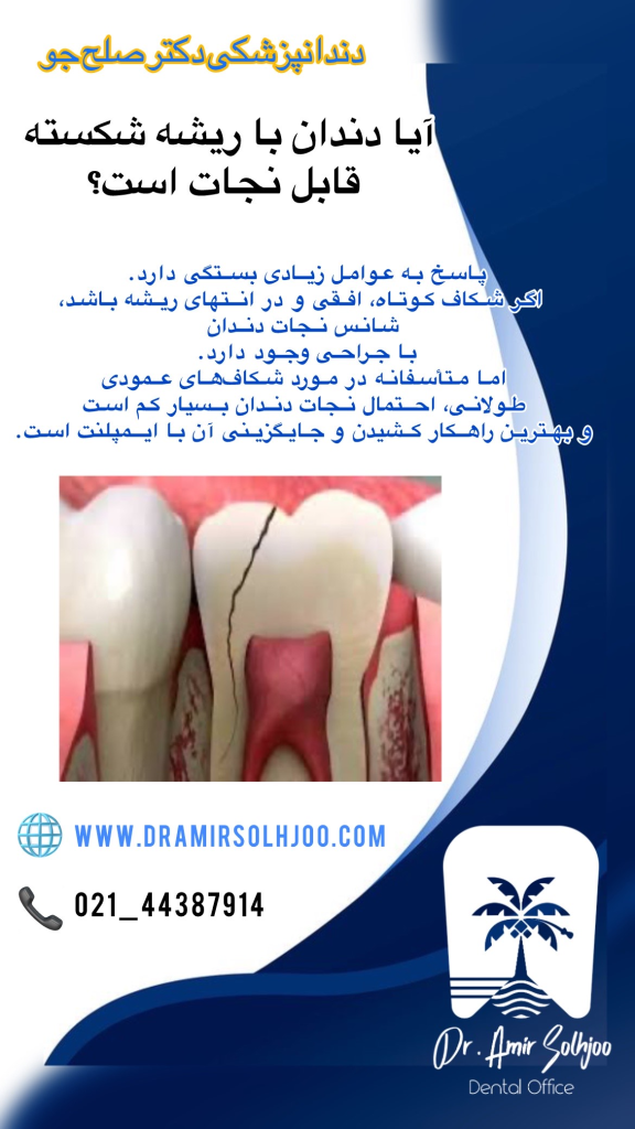 شکستگی ریشه دندان