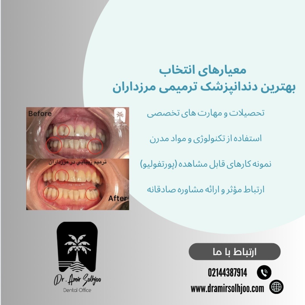 بهترین دندانپزشک ترمیمی مرزداران