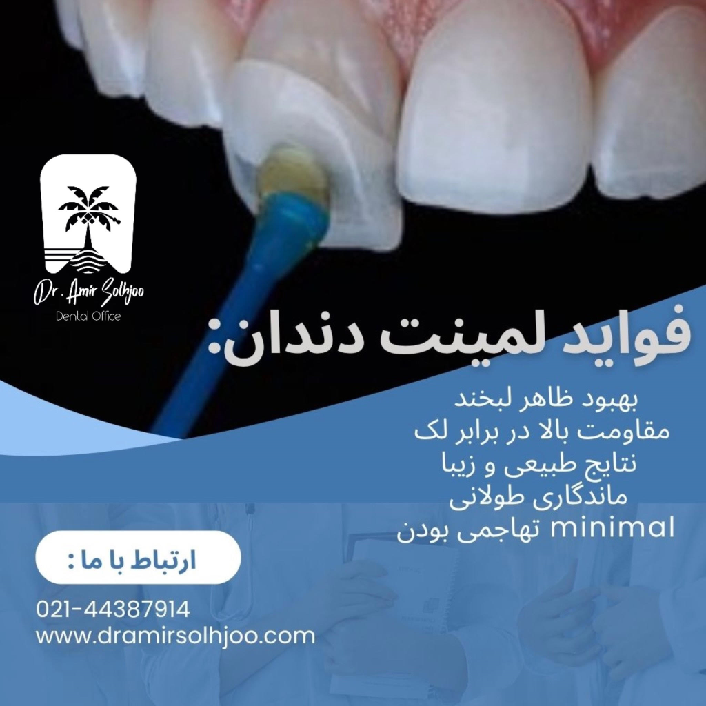 بهترین دکتر لمینت در مرزداران