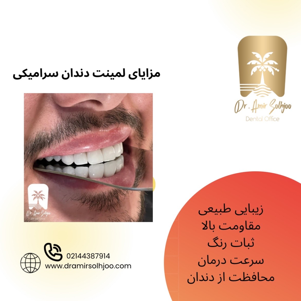 قیمت لمینت دندان سرامیکی در مرزداران