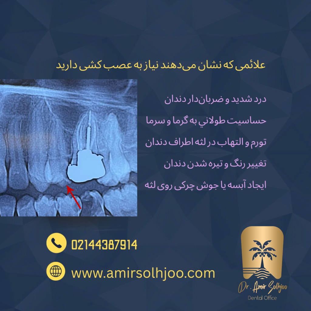 عصب کشی بدون درد در بلوار فردوس