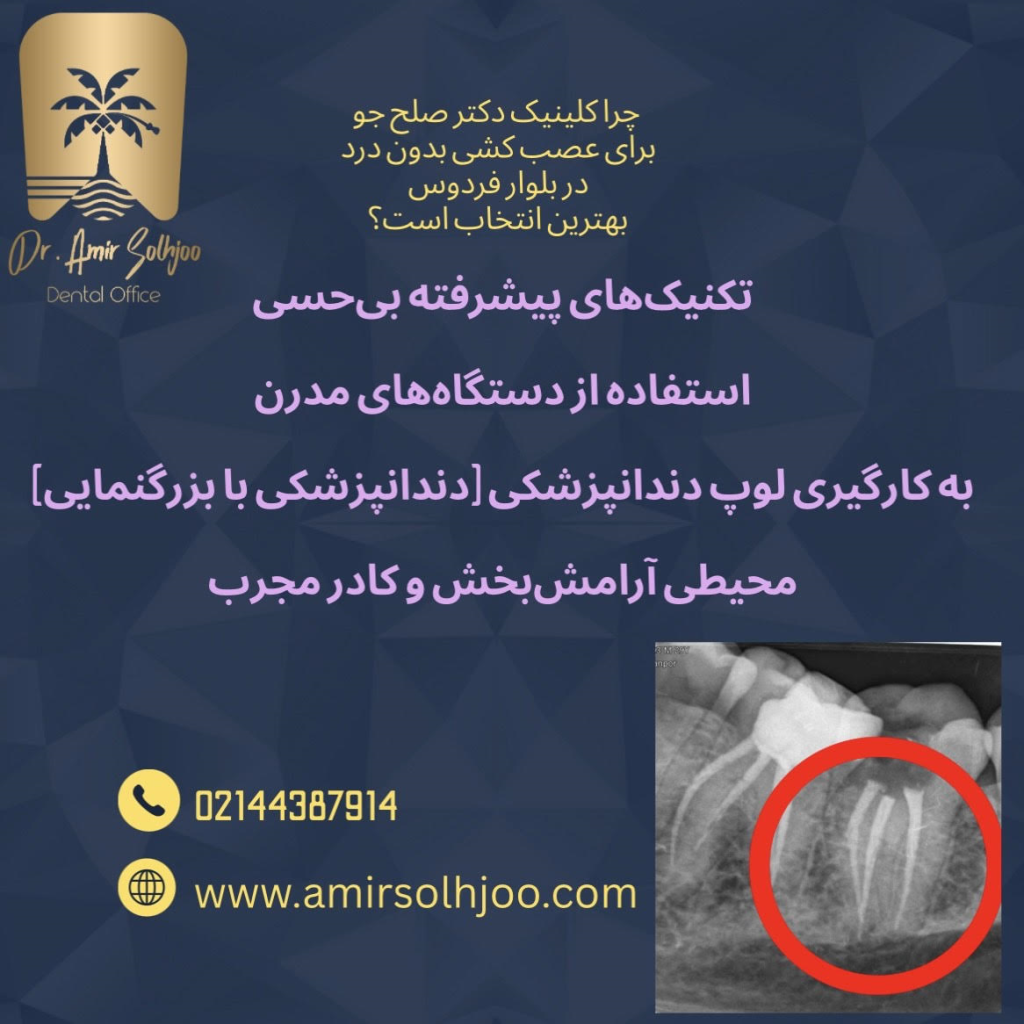 عصب کشی بدون درد در بلوار فردوس
