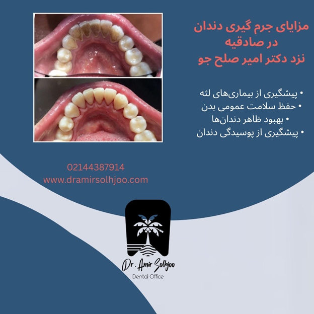 بهترین مرکز جرمگیری دندان در صادقیه