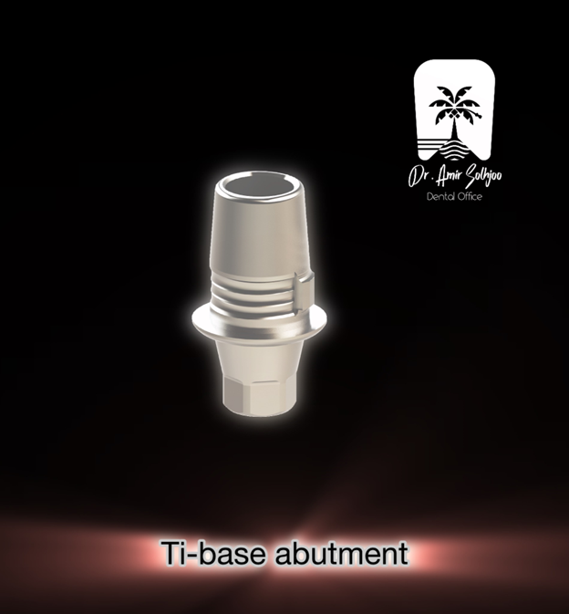 اباتمنت Ti-base