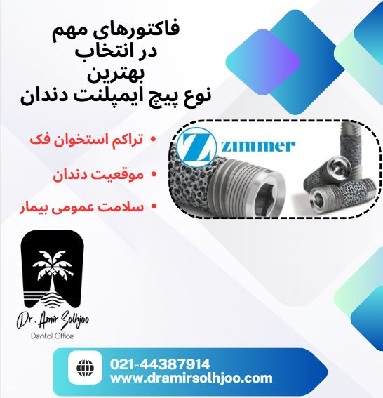 بهترین نوع پیچ ایمپلنت دندان