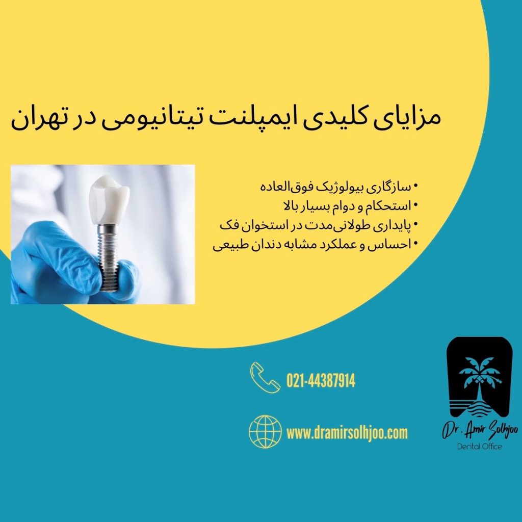 ایمپلنت تیتانیومی در تهران