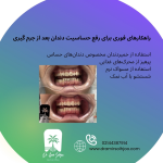 رفع حساسیت دندان بعد از جرم گیری