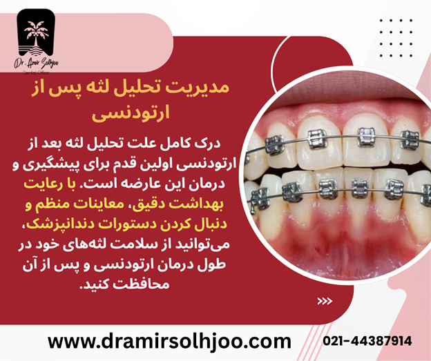 علت تحلیل لثه بعد از ارتودنسی