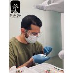 قیمت عصب کشی در مرزداران