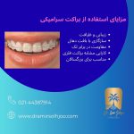 براکت سرامیکی