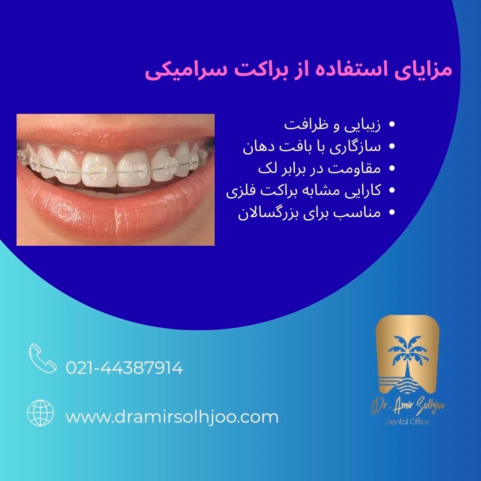 براکت سرامیکی