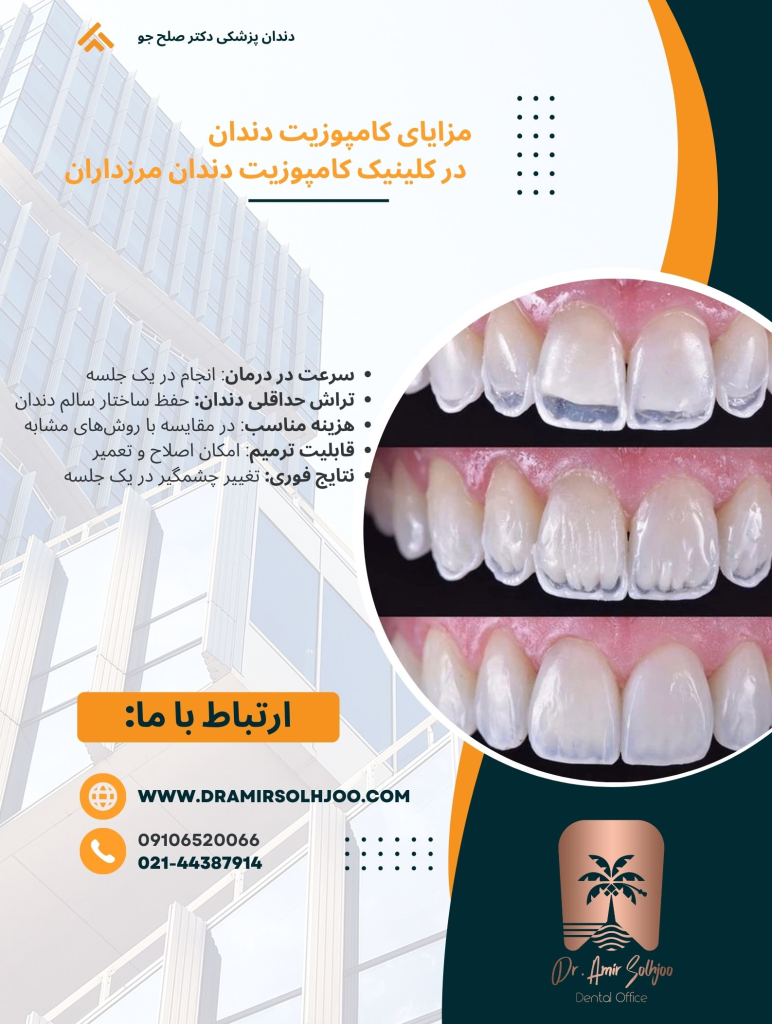کلینیک کامپوزیت دندان مرزداران