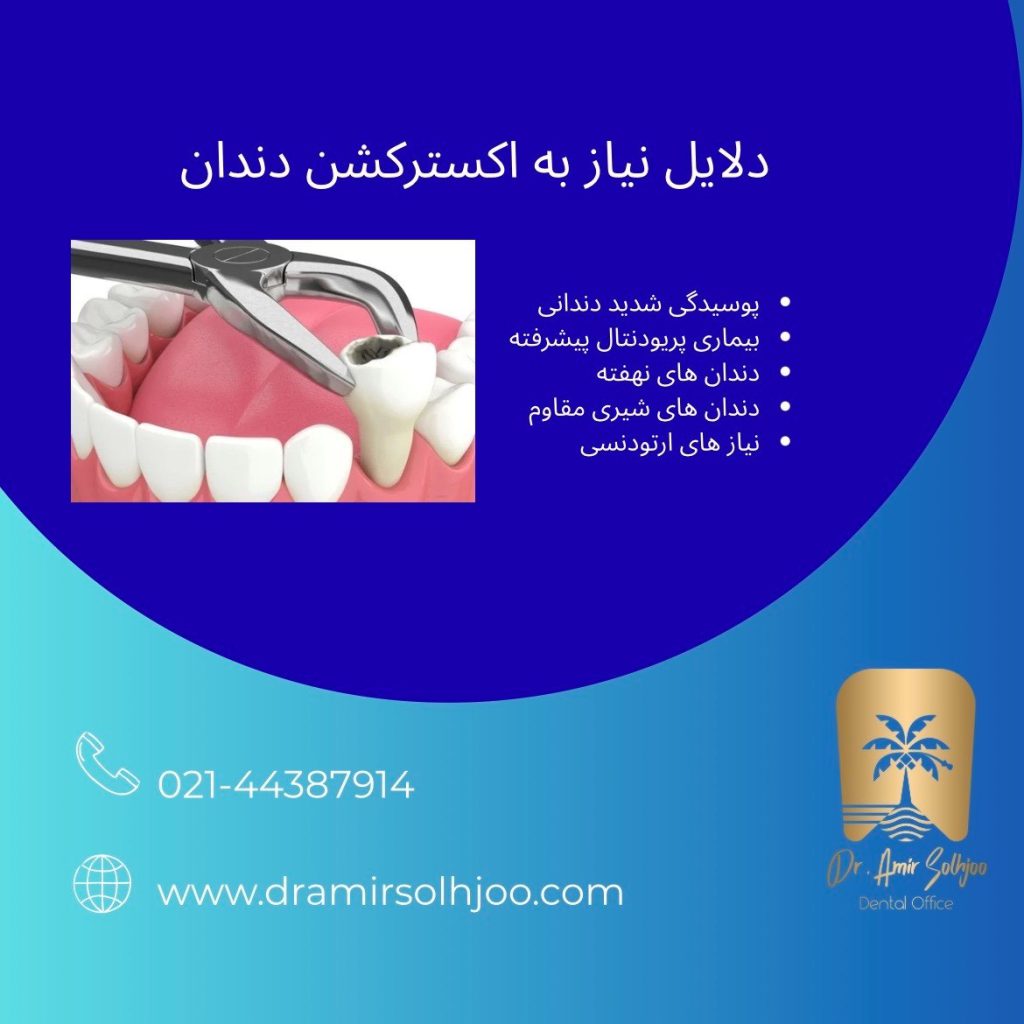 اکسترکشن دندان