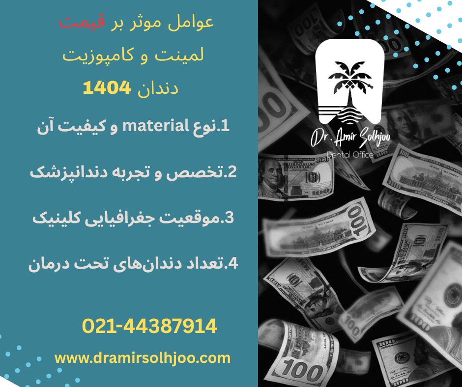قیمت لمینت و کامپوزیت دندان