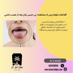 بی حسی زبان بعد از عصب کشی | راهنمای کامل درمان و پیشگیری