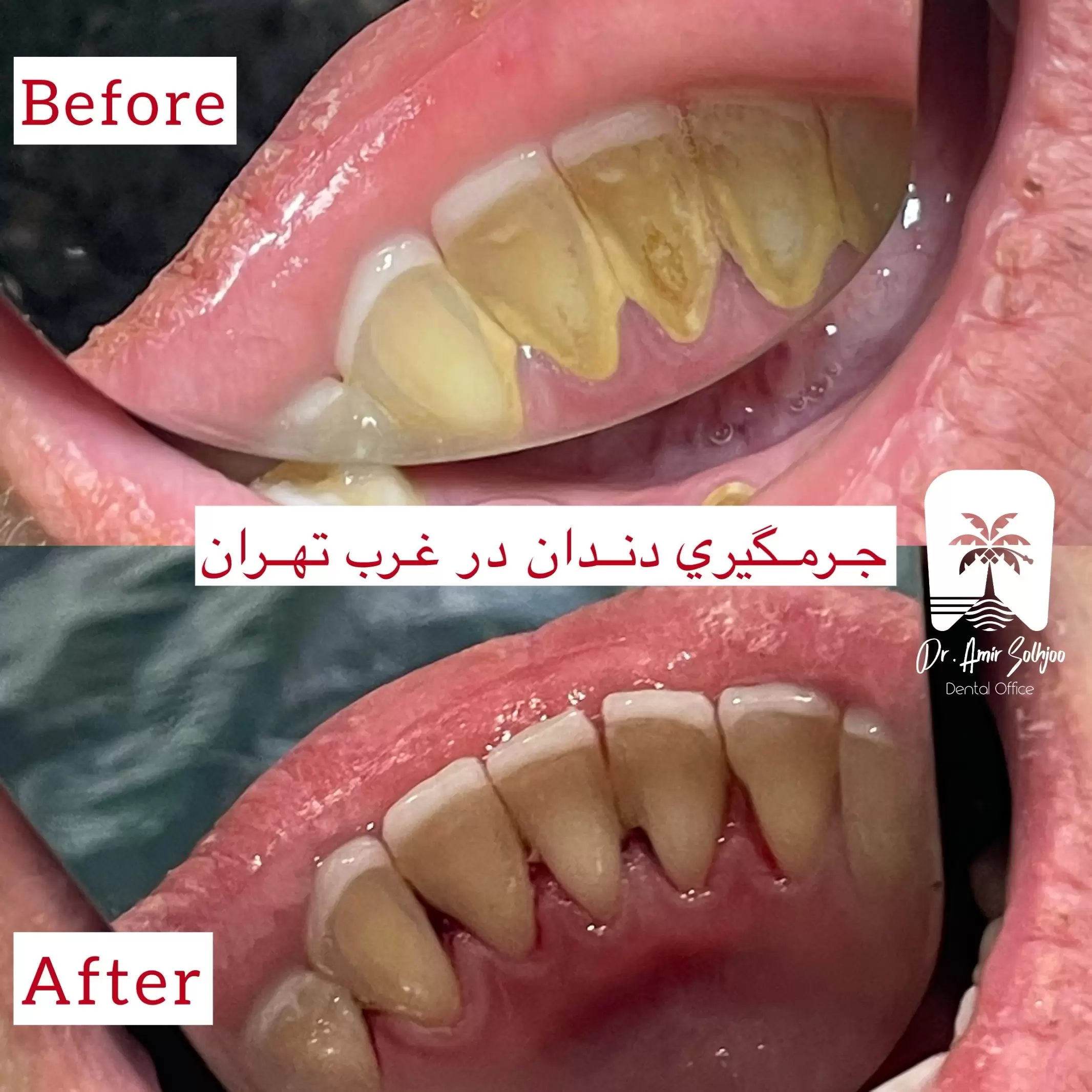 هزینه جرم گیری غرب تهران
